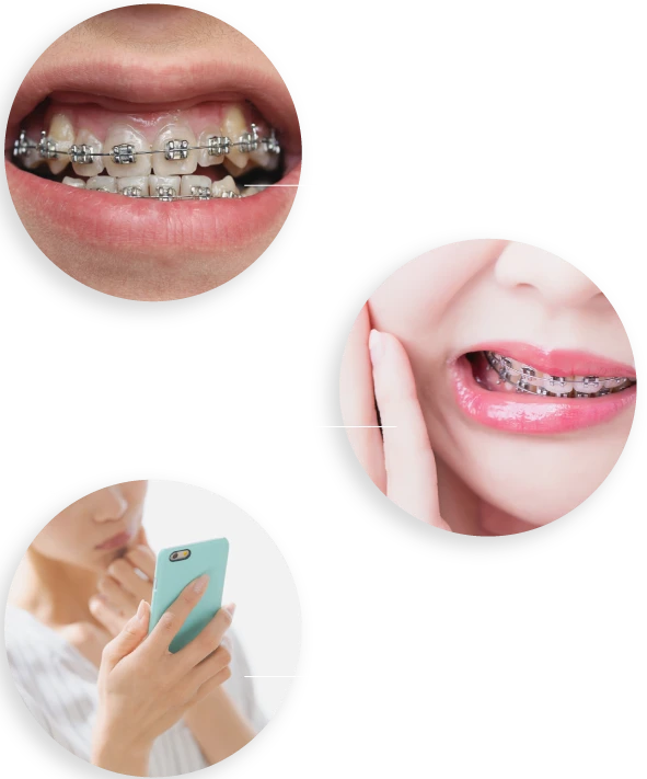 目立つ、痛そう、高い