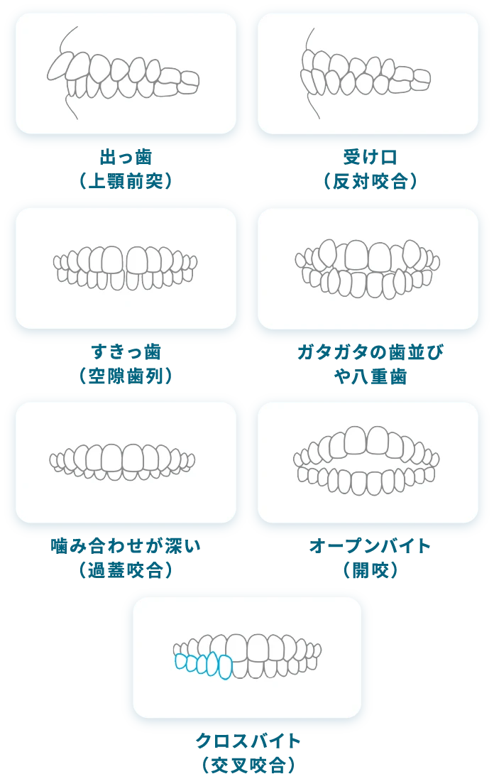 さまざまな歯並びに対応