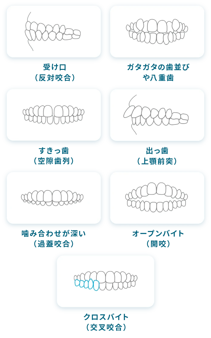 さまざまな歯並びに対応