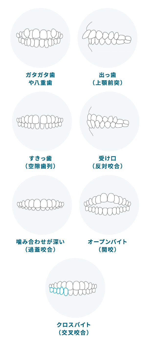 さまざまな歯並び？