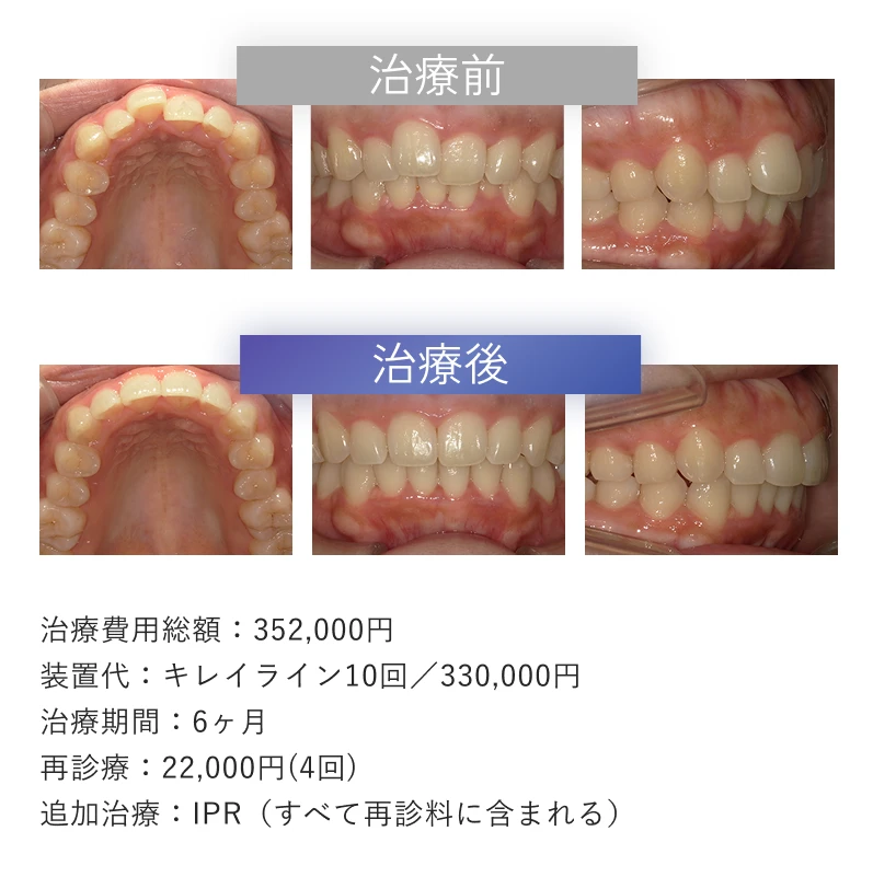 症例1