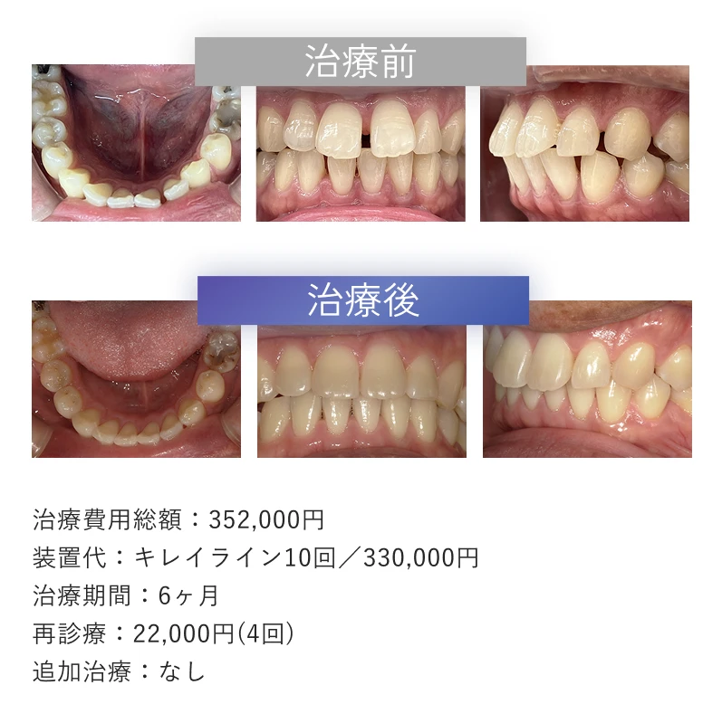 症例2