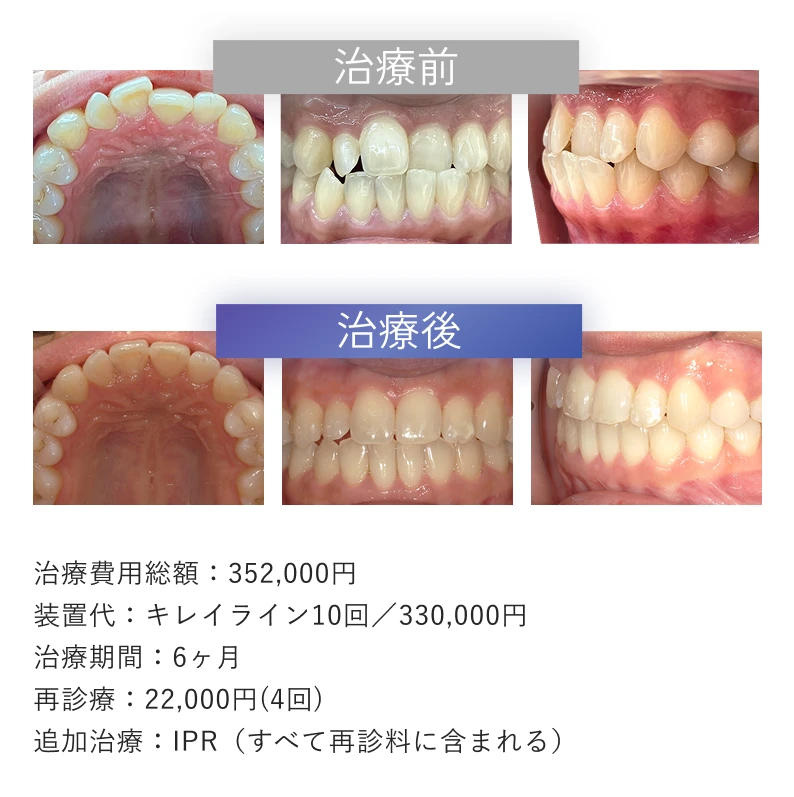 症例3