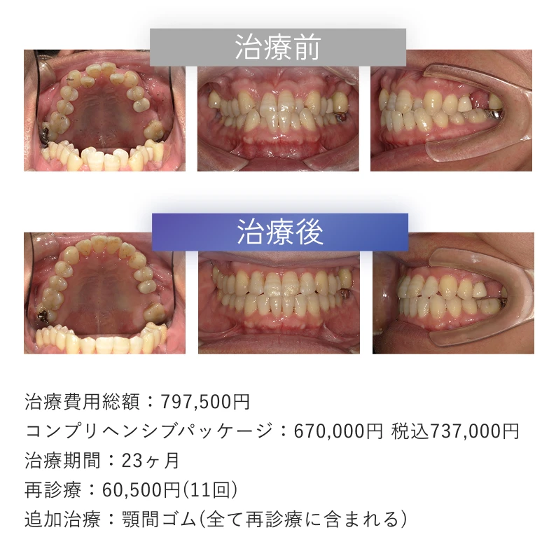 症例1