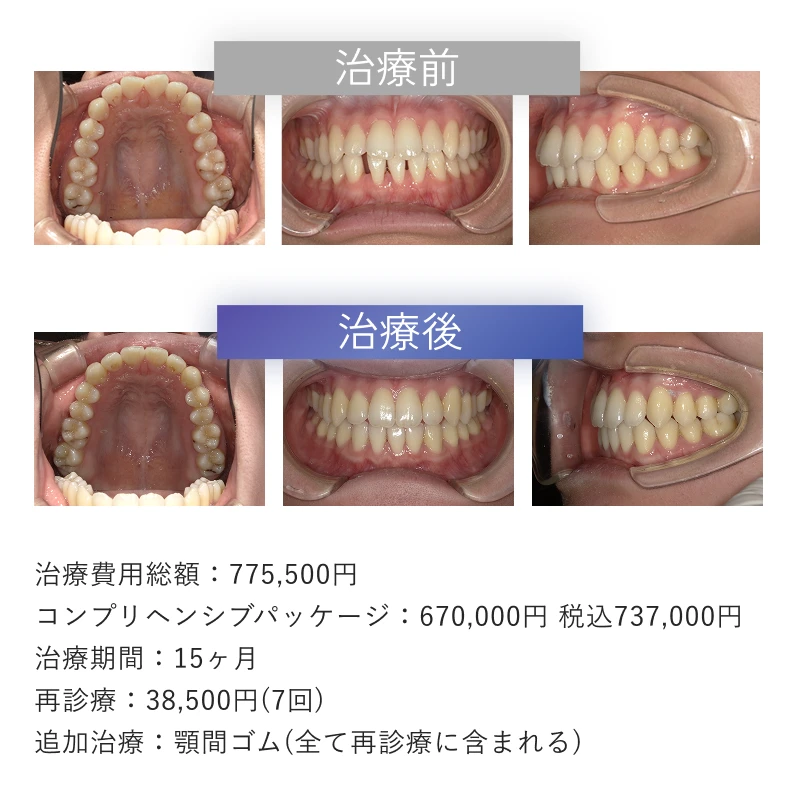 症例2