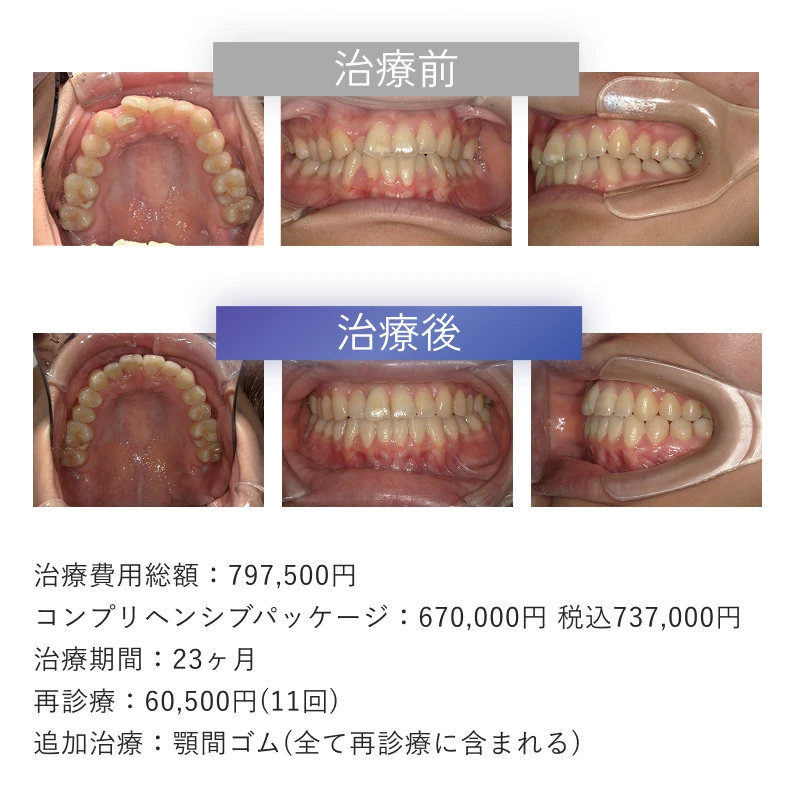 症例3