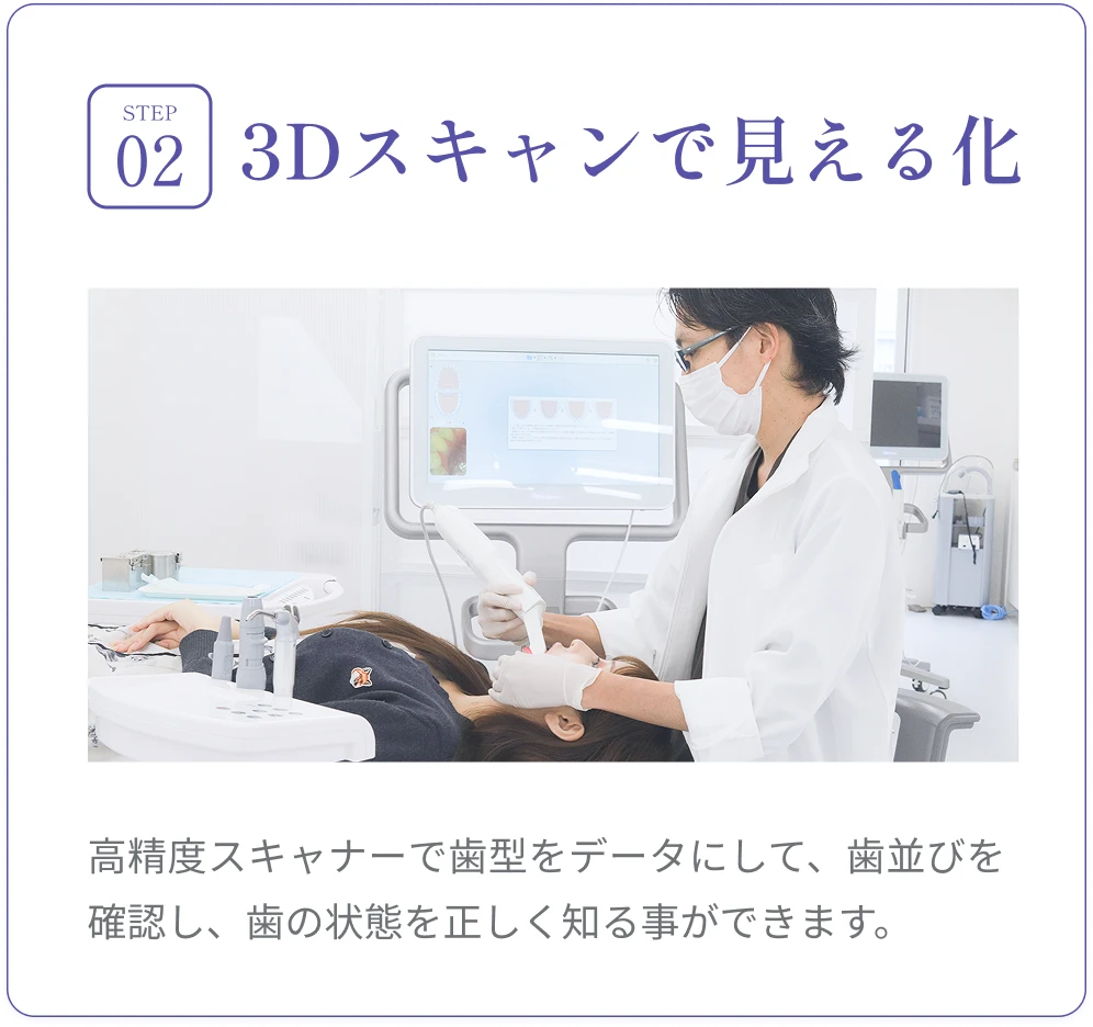 高精度な3Dスキャナ（iTero）で歯型を採取。わずか5分で完了